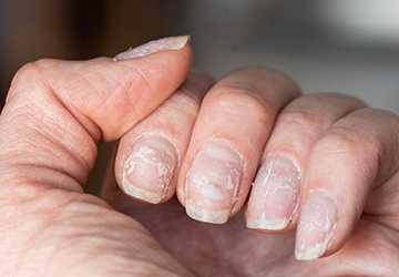 5 Advantages of Incorporating Cuticle Oil into Your Nail Care Regimen